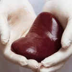 In-Which-Situations-is-Kidney-Transplantation-Performed