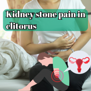 Kidney Stones and Clitoral Pain