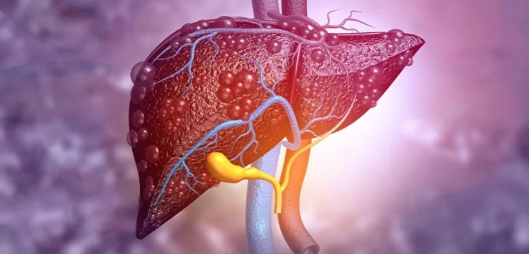 Liver-Cancer-