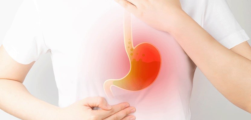 Procedure of Gastric Bypass