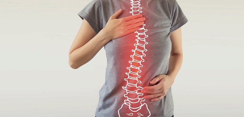 How Should the Recovery Process Be Managed After Scoliosis Treatment