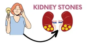 What Cause kidney stones