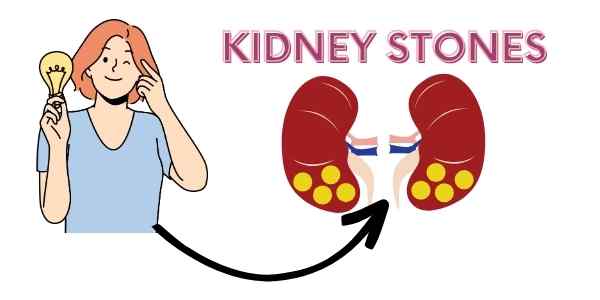 What Cause kidney stones