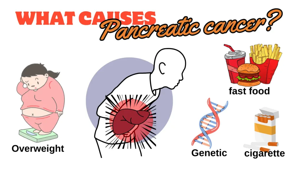 What causes pancreatic cancer