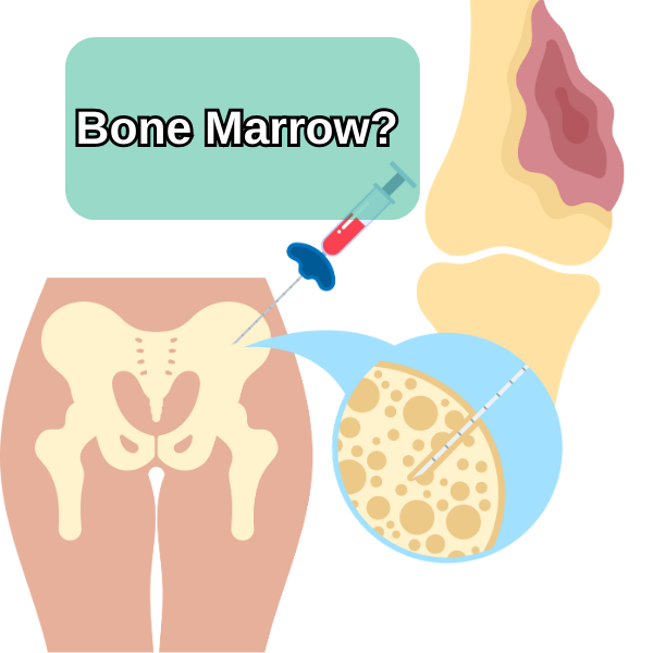 bone marrow biopsy