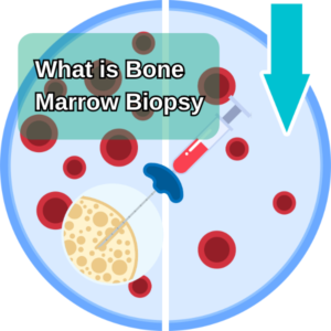 Bone Marrow Biopsy