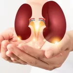 What-is-Kidney-Transplant