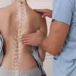 What is Scoliosis