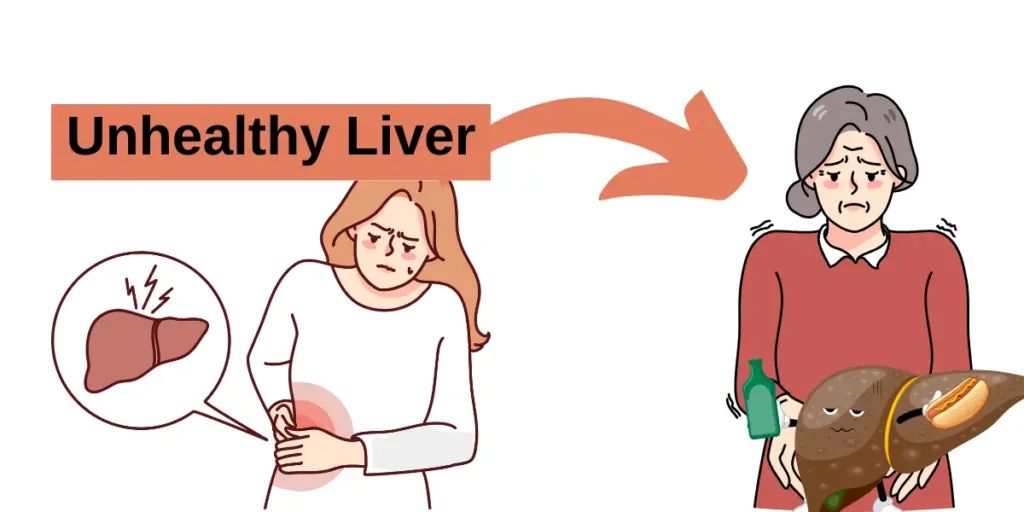 fatty liver 