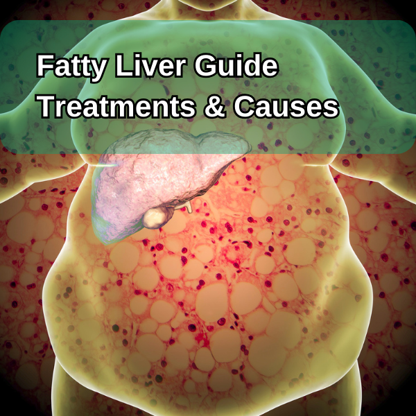 Fatty liver Guide disease causes symptoms treatment