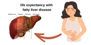 life expectancy with fatty liver disease